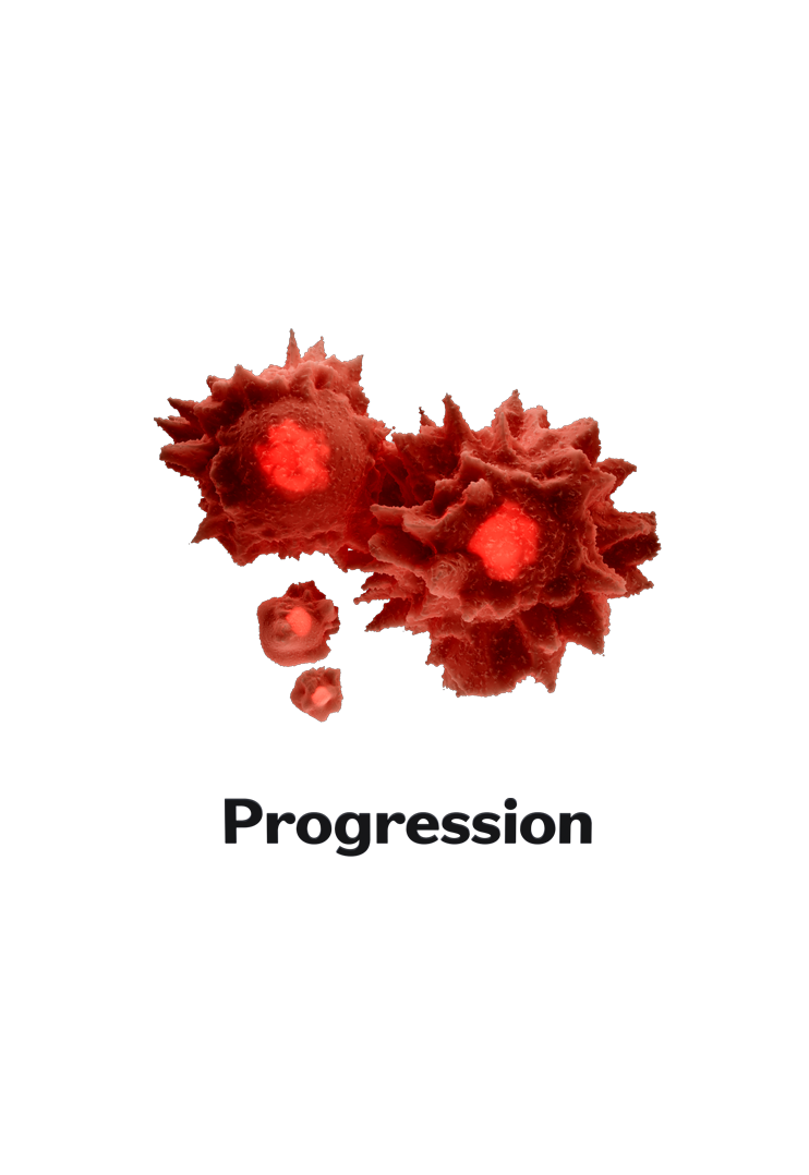 Image of a slot machine reel showing 2 tumors captioned by the word 'PROGRESSION